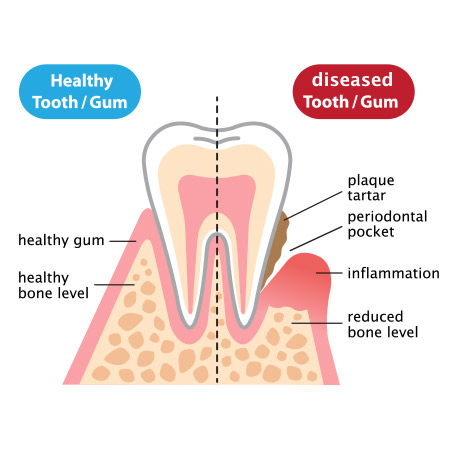 Periodontal Services